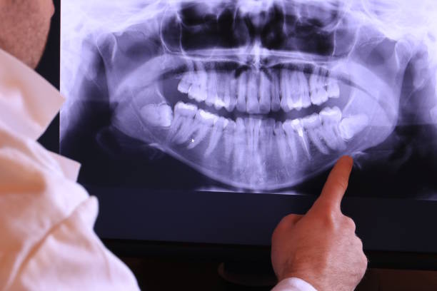 Best Weekend Emergency Dentist in Perryton, TX