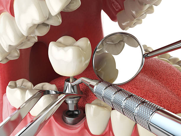 Best Emergency TMJ Treatment in Perryton, TX